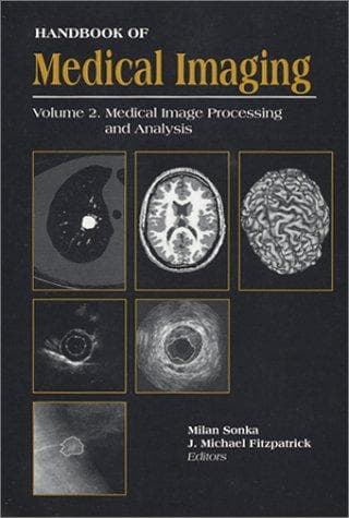 "Handbook of Medical Imaging, Volume 2. Medical Image Processing and Analysis (SPIE Press Monograph Vol. PM80)"