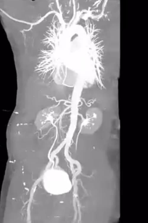 X-Ray Eros